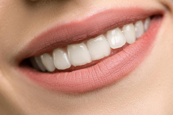 cosmetic-teeth-white