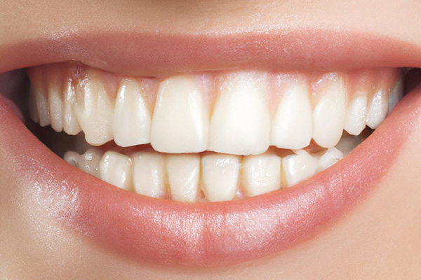 cosmetic-white-teeth