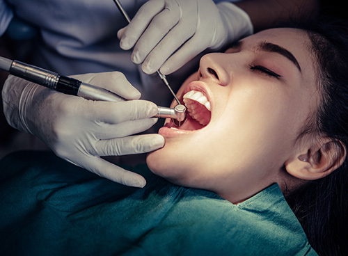 root-canal